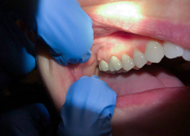 Best Emergency Broken Tooth Repair in Tucson Mountains, AZ